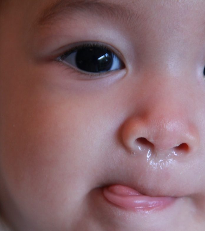 52af1736-08e5-446c-b042-e99eee4b78be-shutterstock-681378793 How to clear a stuffy nose?